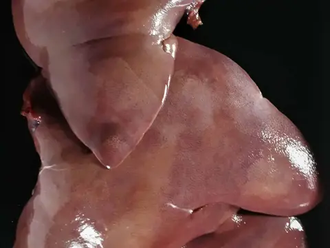 Schweineleber